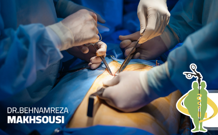 جراحی کیسه صفرا به روش لاپاراسکوپی