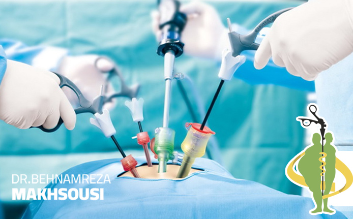 جراحی لاپاراسکوپی بر روی دستگاه گوارش